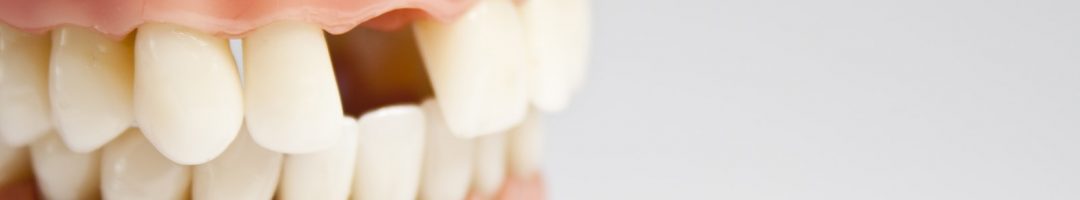 La perte des dents est-elle inévitable avec l’âge ?